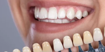 ویژگی های بهترین دکتر کامپوزیت